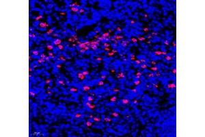 Immunofluorescence of paraffin embedded mouse spleen using IL-23R (ABIN7074355) at dilution of 1:200 (400x lens) (IL23R antibody)