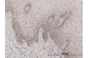 Immunoperoxidase of monoclonal antibody to SAP30 on formalin-fixed paraffin-embedded human esophagus. (SAP30 antibody  (AA 131-219))