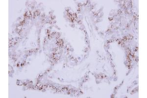 IHC-P Image Immunohistochemical analysis of paraffin-embedded OVCA xenograft, using CD75, antibody at 1:500 dilution. (ST6GAL1 antibody  (Center))