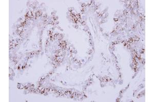 IHC-P Image Immunohistochemical analysis of paraffin-embedded OVCA xenograft, using CD75, antibody at 1:500 dilution. (ST6GAL1 antibody  (Center))