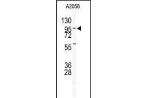 Western blot analysis of anti-USP5 Antibody in A2058 cell line lysates (35ug/lane) (USP5 antibody  (N-Term))
