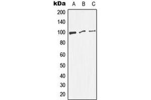 Western blot analysis of Dynamin 1 (pS774) expression in HeLa (A), NIH3T3 (B), PC12 (C) whole cell lysates. (Dynamin 1 antibody  (C-Term, pSer774))