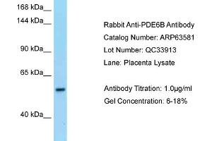Western Blotting (WB) image for anti-phosphodiesterase 6B, CGMP-Specific, Rod, beta (PDE6B) (N-Term) antibody (ABIN2789554) (PDE6B antibody  (N-Term))