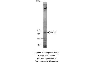 Image no. 2 for anti-Nucleotide-Binding Oligomerization Domain Containing 2 (NOD2) (AA 28-301) antibody (ABIN363229)