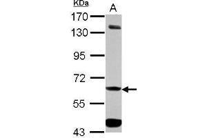 WB Image Sample (30 ug of whole cell lysate) A: HepG2 7. (ALDH7A1 antibody)