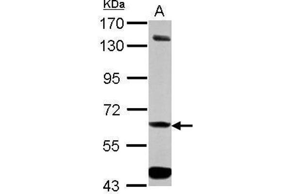 ALDH7A1 antibody