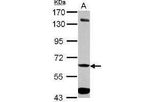 ALDH7A1 anticorps