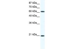 WB Suggested Anti-Anxa6 Antibody Titration:  1. (ANXA6 antibody  (C-Term))