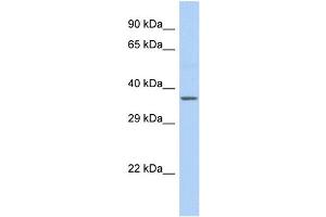 Host:  Rabbit  Target Name:  cytb  Sample Type:  Fetal Liver lysates  Antibody Dilution:  1. (Cytochrome b antibody  (C-Term))