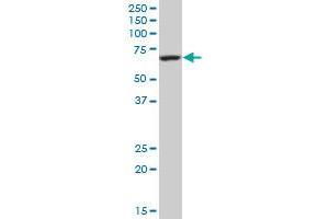 GATAD2B polyclonal antibody (A01), Lot # 051114JC01 Western Blot analysis of GATAD2B expression in Hela S3 NE . (GATAD2B antibody  (AA 3-110))