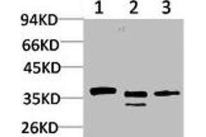 Western blot analysis of 1) Human Brain Tissue, 2) Mouse Brain Tissue, 3) Rat Brain Tissue using CACNG2 Polyclonal Antibody. (Stargazin antibody)