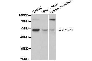 Western blot analysis of extracts of various cell lines, using CYP19A1 antibody. (Aromatase antibody)