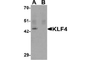 Image no. 1 for anti-Kruppel-Like Factor 4 (Gut) (KLF4) (C-Term) antibody (ABIN1449394) (KLF4 antibody  (C-Term))