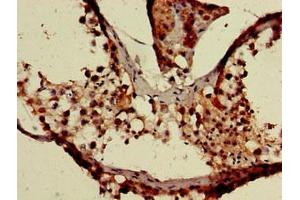 Immunohistochemistry of paraffin-embedded human testis tissue using ABIN7175921 at dilution of 1:100 (XAF1 antibody  (AA 172-259))