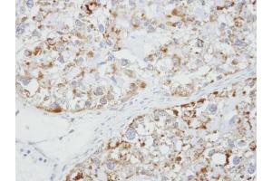 IHC-P Image Immunohistochemical analysis of paraffin-embedded OVCA xenograft, using Glycine Receptor alpha1, antibody at 1:100 dilution. (GLRA1 antibody)