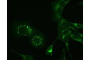 Immunofluorescence microscopy using Immunochemical anti-MHV-A59 nsp9 antibody, 6-h post infection in mouse L cells. (MHV NSP9 antibody)