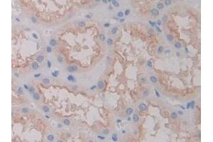 Detection of FOLR1 in Human Kidney Tissue using Polyclonal Antibody to Folate Receptor 1, Adult (FOLR1) (FOLR1 antibody  (AA 25-234))