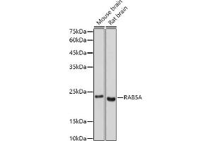Western blot analysis of extracts of various cell lines, using RA antibody (ABIN3021646, ABIN3021647, ABIN3021648 and ABIN1513457) at 1:500 dilution. (RAB5 antibody  (AA 1-215))
