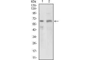 Western blot analysis using GPNMB mouse mAb against PANC1 (1) and PC-3 (2) cell lysate. (Osteoactivin antibody  (AA 31-260))