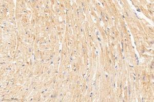 Immunohistochemistry analysis of paraffin-embedded mouse heart using,MTND1 (ABIN7074658) at dilution of 1: 1000 (MT-ND1 antibody)