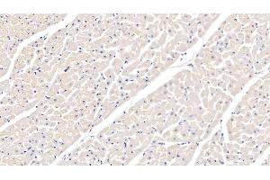 Detection of ITGa5 in Bovine Cardiac Muscle Tissue using Polyclonal Antibody to Integrin Alpha 5 (ITGa5) (ITGA5 antibody  (AA 649-900))