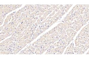 Detection of ITGa5 in Bovine Cardiac Muscle Tissue using Polyclonal Antibody to Integrin Alpha 5 (ITGa5) (ITGA5 antibody  (AA 649-900))