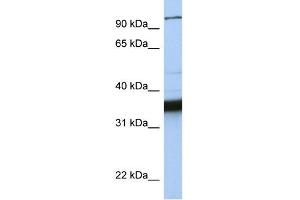WB Suggested Anti-KIFC3 Antibody Titration:  0. (KIFC3 antibody  (C-Term))
