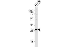 Western Blotting (WB) image for anti-Nicotinamide N-Methyltransferase (NNMT) antibody (ABIN2997531) (NNMT antibody)