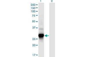 Western Blot analysis of C4orf43 expression in transfected 293T cell line by C4orf43 monoclonal antibody (M08), clone 4A6. (C4orf43 antibody  (AA 1-203))