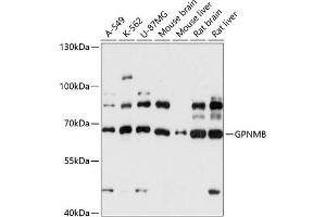 Western blot analysis of extracts of various cell lines, using GPNMB antibody (ABIN7269117) at 1:3000 dilution. (Osteoactivin antibody  (AA 22-260))