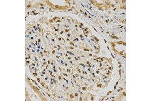 Immunohistochemistry (IHC) image for anti-Heterogeneous Nuclear Ribonucleoprotein A2/B1 (HNRNPA2B1) (AA 1-180) antibody (ABIN3021593)