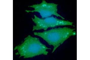 ICC/IF analysis of NDRG1 in HeLa cells line, stained with DAPI (Blue) for nucleus staining and monoclonal anti-human NDRG1 antibody (1:100) with goat anti-mouse IgG-Alexa fluor 488 conjugate (Green). (NDRG1 antibody  (AA 1-394))