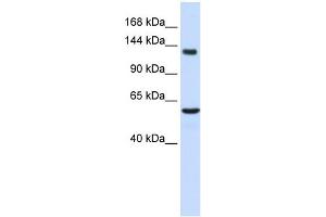 WB Suggested Anti-IGSF1 Antibody Titration:  0. (IGSF1 antibody  (Middle Region))