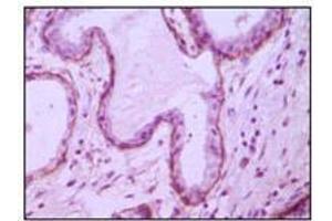 Immunohistochemical analysis of paraffin-embedded human breast ductal myoepithelium,showing cytoplasmic and membrane location with DAB staining using CD10 mouse mAb. (MME antibody)