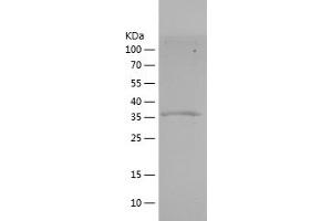 MSTN Protein (AA 267-375) (His-IF2DI Tag)