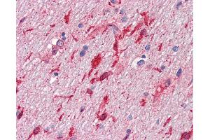 Anti-HGF antibody IHC of human brain, cerebellum, white matter. (HGF antibody)