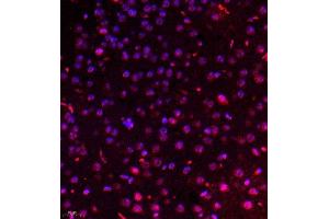 Immunofluorescence of paraffin embedded mouse brain using USP34 (ABIN7076115) at dilution of 1:700 (400x lens) (USP34 antibody)