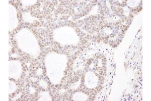 Immunohistochemistry (IHC) image for anti-Chromodomain Helicase DNA Binding Protein 3 (CHD3) (AA 1950-2000) antibody (ABIN7448475) (CHD3 antibody  (AA 1950-2000))