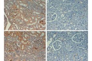 Immunohistochemistry (IHC) image for anti-Fibronectin 1 (FN1) antibody (Biotin) (ABIN5596762)