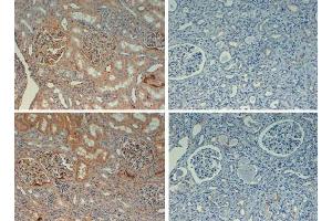 Immunohistochemistry with rabbit anti fibronectin biotin conjugated at 20X with negative controls (right). (Fibronectin antibody  (Biotin))