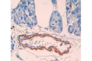Figure. (CPT1B antibody  (AA 602-772))