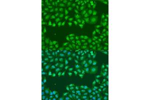 Immunofluorescence analysis of U2OS cells using SSB antibody (ABIN1874948) at dilution of 1:100. (SSB antibody)