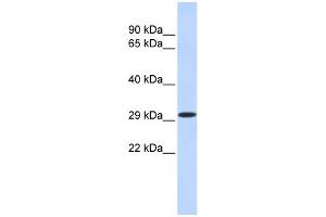 WB Suggested Anti-KLF14 Antibody Titration:  0.