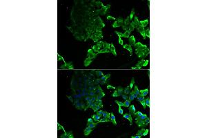 Immunofluorescence analysis of MCF-7 cells using SCYL1 antibody (ABIN5974072). (SCYL1 antibody)