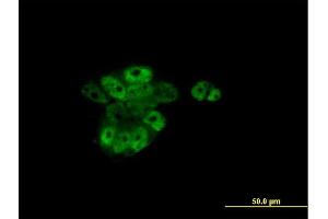 Immunofluorescence of monoclonal antibody to RARA on A-431 cell. (Retinoic Acid Receptor alpha antibody  (AA 1-462))