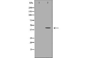 Western blot analysis of HepG2  lysate using AKR7A2 antibody. (AKR7A2 antibody  (Internal Region))