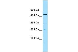 WB Suggested Anti-CGGBP1 Antibody Titration: 1. (CGGBP1 antibody  (N-Term))
