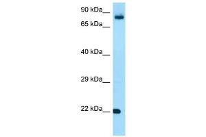 WB Suggested Anti-FGF18 Antibody Titration: 1. (FGF18 antibody  (C-Term))