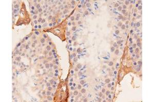 ABIN6267537 at 1/100 staining mouse kidney tissue sections by IHC-P. (YAP1 antibody  (pSer127))