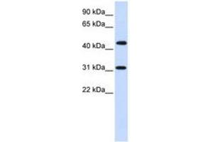 Image no. 1 for anti-Zinc Finger Protein 684 (ZNF684) (AA 72-121) antibody (ABIN6740403)